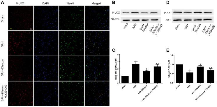 https://cdn.ncbi.nlm.nih.gov/pmc/blobs/cbcf/8109136/0ae2ebc52e44/aging-13-202869-g002.jpg