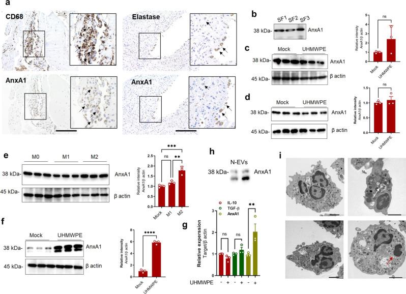 https://cdn.ncbi.nlm.nih.gov/pmc/blobs/cbd5/9262976/f7d0ad33c301/41467_2022_31646_Fig1_HTML.jpg