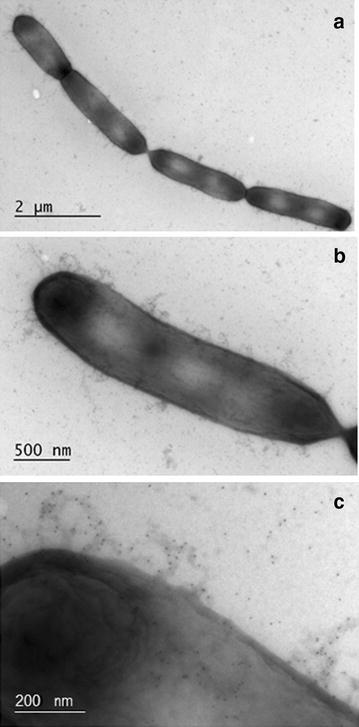 https://cdn.ncbi.nlm.nih.gov/pmc/blobs/cbde/4672519/591d8644a419/12934_2015_370_Fig4_HTML.jpg