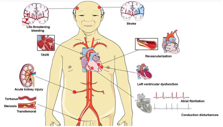 https://cdn.ncbi.nlm.nih.gov/pmc/blobs/cbdf/10380827/54a8851ea801/jcdd-10-00279-g001.jpg