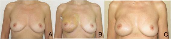 https://cdn.ncbi.nlm.nih.gov/pmc/blobs/cbe1/4268891/b1e1ce0198a1/13046_2014_78_Fig1_HTML.jpg