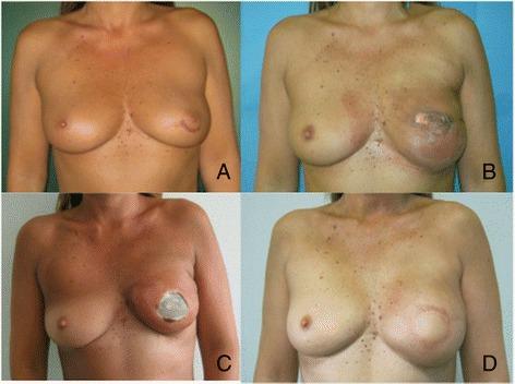 https://cdn.ncbi.nlm.nih.gov/pmc/blobs/cbe1/4268891/f0ed2c93e7e2/13046_2014_78_Fig3_HTML.jpg