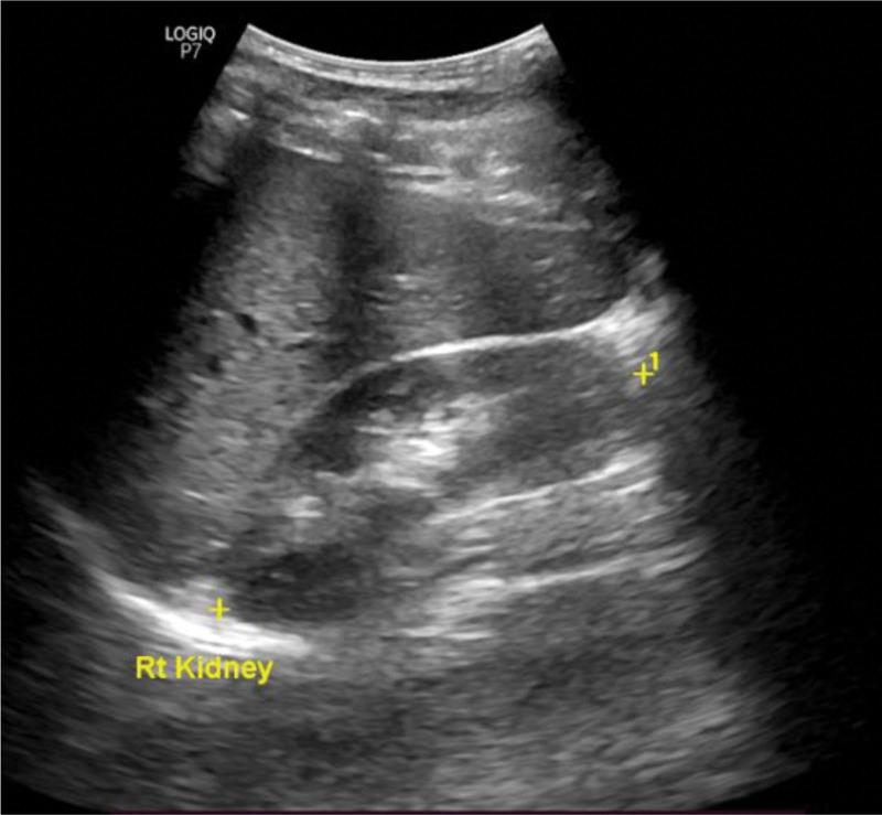 https://cdn.ncbi.nlm.nih.gov/pmc/blobs/cbe8/11175874/164c1fe9a190/medi-103-e38607-g001.jpg