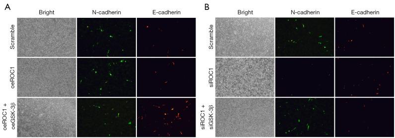 https://cdn.ncbi.nlm.nih.gov/pmc/blobs/cbe8/12076244/17dd377b79ec/tau-14-04-974-f5.jpg
