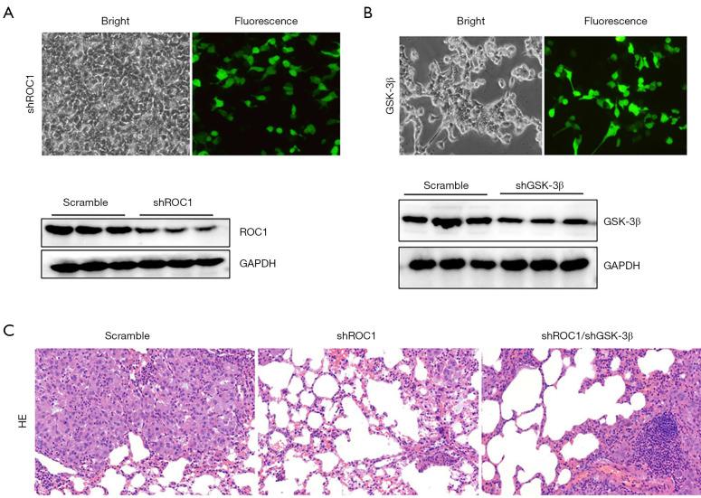 https://cdn.ncbi.nlm.nih.gov/pmc/blobs/cbe8/12076244/d1c9e61bf699/tau-14-04-974-f6.jpg