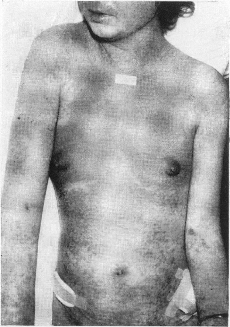 https://cdn.ncbi.nlm.nih.gov/pmc/blobs/cbea/2312284/bbf34461cb93/annrcse00247-0039-a.jpg