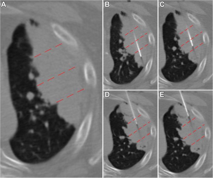 https://cdn.ncbi.nlm.nih.gov/pmc/blobs/cbea/8581369/c0b7876c835b/gr3.jpg
