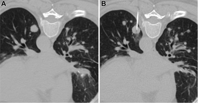 https://cdn.ncbi.nlm.nih.gov/pmc/blobs/cbea/8581369/cd381f4721cd/gr2.jpg