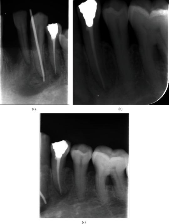 https://cdn.ncbi.nlm.nih.gov/pmc/blobs/cbeb/8154279/aebeccf82b52/CRID2021-5570758.002.jpg