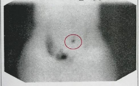 https://cdn.ncbi.nlm.nih.gov/pmc/blobs/cbf8/5672113/5adadbbcc091/OAMJMS-5-744-g002.jpg