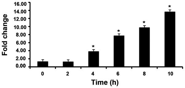 https://cdn.ncbi.nlm.nih.gov/pmc/blobs/cbfd/7411367/61d9b20c8828/MMR-22-03-2263-g01.jpg
