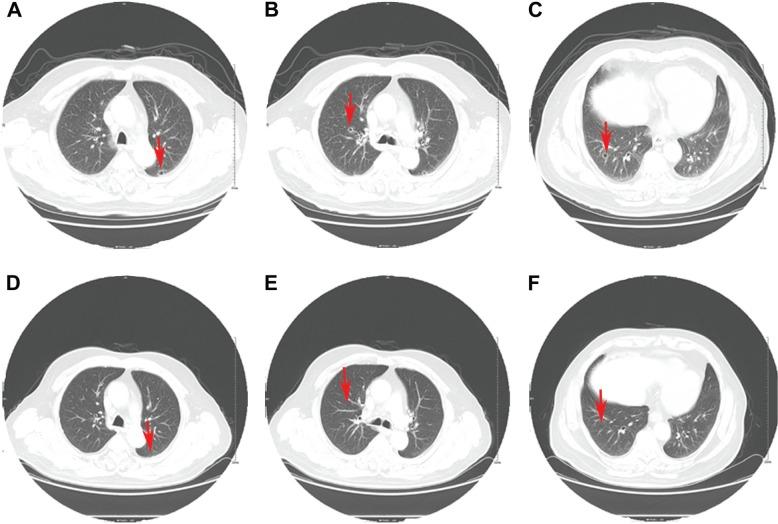 https://cdn.ncbi.nlm.nih.gov/pmc/blobs/cbff/4986673/c366ed655d76/ott-9-4989Fig2.jpg