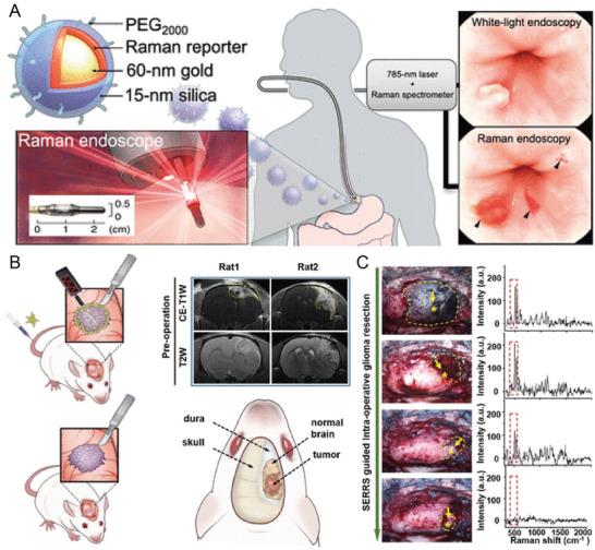 https://cdn.ncbi.nlm.nih.gov/pmc/blobs/cc03/10015885/ce9d0036e8f4/ADVS-10-2202051-g006.jpg