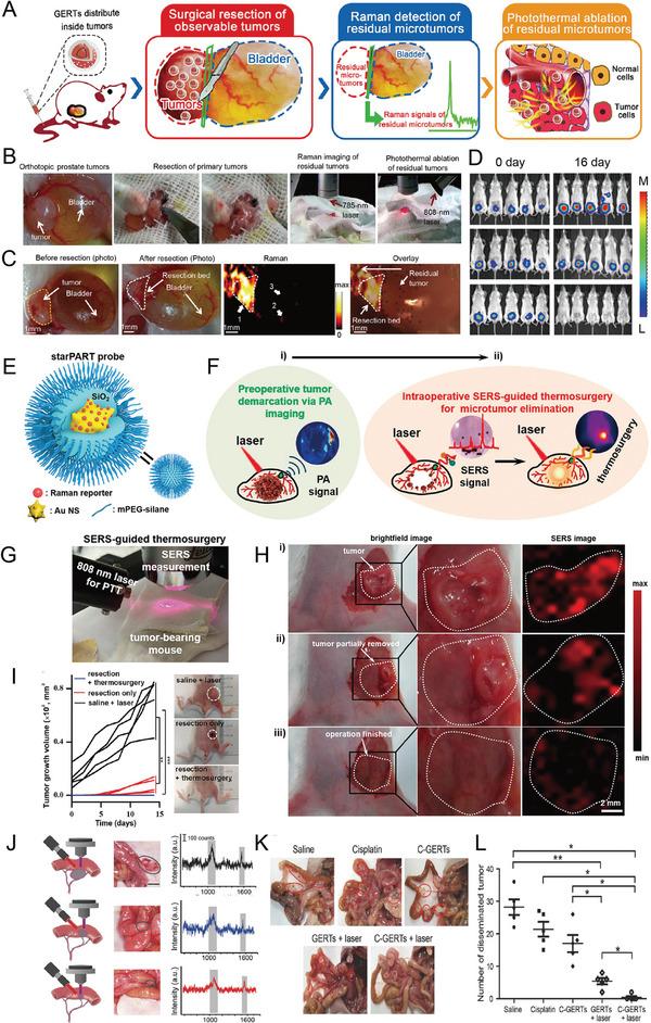 https://cdn.ncbi.nlm.nih.gov/pmc/blobs/cc03/10015885/d959713ace8b/ADVS-10-2202051-g011.jpg