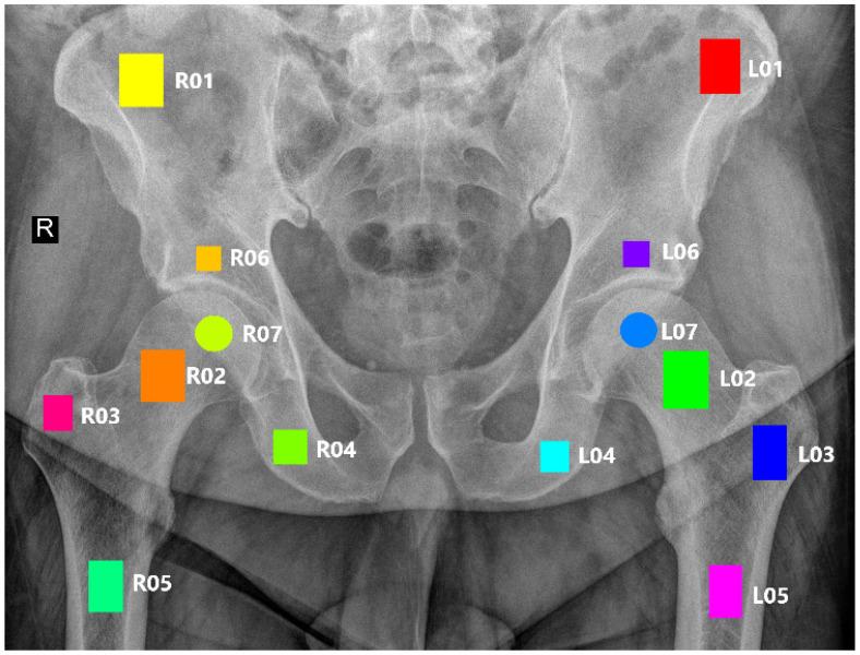 https://cdn.ncbi.nlm.nih.gov/pmc/blobs/cc07/11012966/6104eb1536a3/jcm-13-01904-g002.jpg