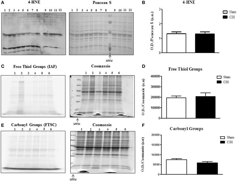 https://cdn.ncbi.nlm.nih.gov/pmc/blobs/cc0b/4311627/67d0fef87d97/fphys-06-00015-g0002.jpg