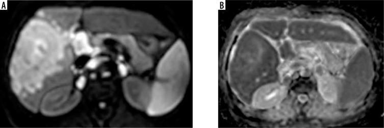 https://cdn.ncbi.nlm.nih.gov/pmc/blobs/cc0d/8814898/eaacddd0f0d7/PJR-87-46332-g009.jpg