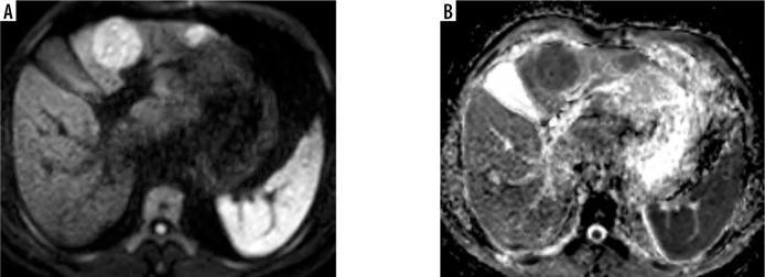 https://cdn.ncbi.nlm.nih.gov/pmc/blobs/cc0d/8814898/f617296e399e/PJR-87-46332-g006.jpg