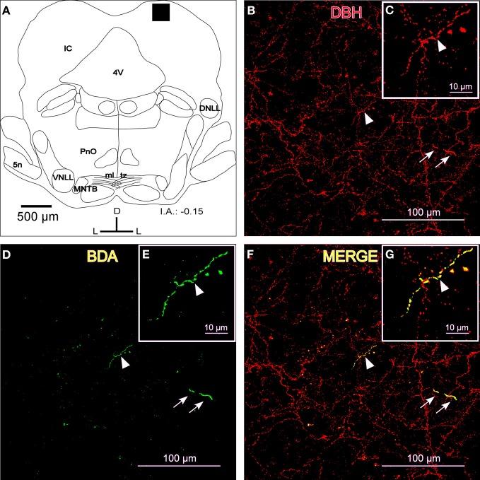 https://cdn.ncbi.nlm.nih.gov/pmc/blobs/cc10/3385004/8bcab8437c32/fncir-06-00041-g0003.jpg