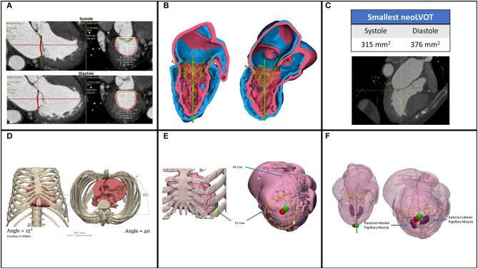 https://cdn.ncbi.nlm.nih.gov/pmc/blobs/cc11/7793646/a2d5e577bc06/fcvm-07-592909-g0004.jpg