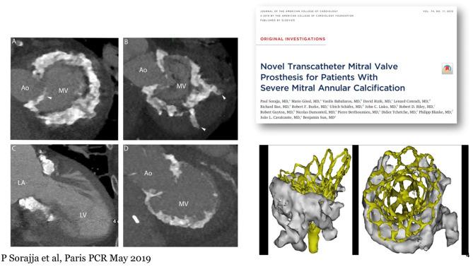 https://cdn.ncbi.nlm.nih.gov/pmc/blobs/cc11/7793646/ffb68131b8fd/fcvm-07-592909-g0010.jpg