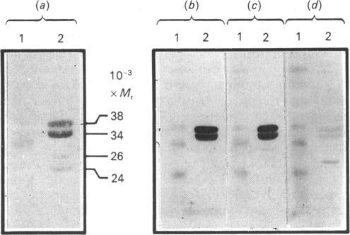 https://cdn.ncbi.nlm.nih.gov/pmc/blobs/cc19/1135565/674658e7ab48/biochemj00216-0263-a.jpg