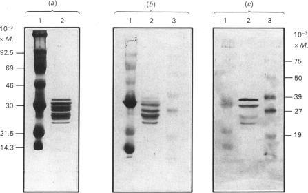 https://cdn.ncbi.nlm.nih.gov/pmc/blobs/cc19/1135565/7c7ae0baa7df/biochemj00216-0261-a.jpg