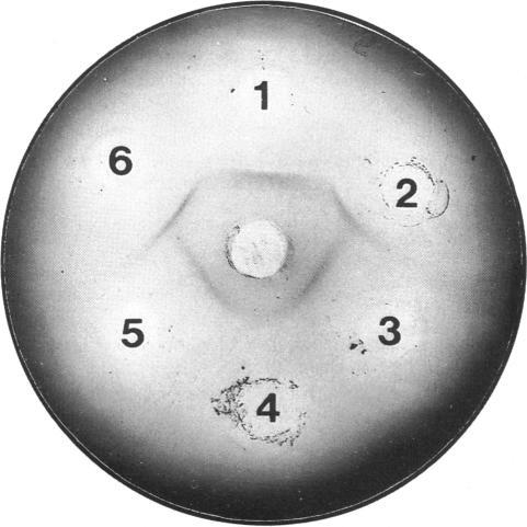 https://cdn.ncbi.nlm.nih.gov/pmc/blobs/cc19/1135565/af868bae5b0e/biochemj00216-0262-a.jpg