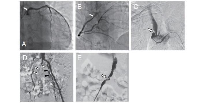 https://cdn.ncbi.nlm.nih.gov/pmc/blobs/cc1b/8326168/9bc41cb601e9/28_RV17053_4.jpg