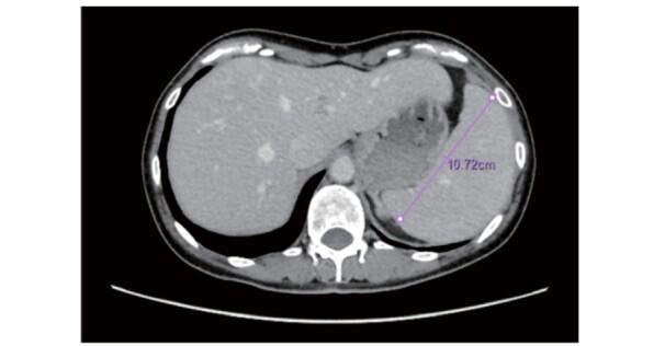 https://cdn.ncbi.nlm.nih.gov/pmc/blobs/cc1b/8326168/bc668158fe4c/28_RV17053_3.jpg