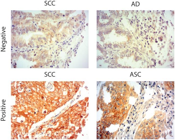 https://cdn.ncbi.nlm.nih.gov/pmc/blobs/cc1c/6361794/b172a1dc75c6/fonc-09-00029-g0001.jpg