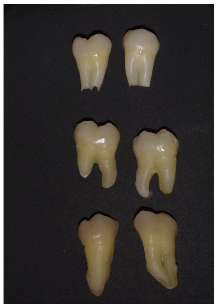 https://cdn.ncbi.nlm.nih.gov/pmc/blobs/cc2c/12385387/4d75fca04add/dentistry-13-00357-g001.jpg