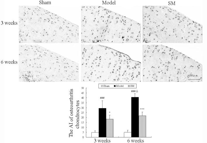 https://cdn.ncbi.nlm.nih.gov/pmc/blobs/cc2d/4151698/a305263bc481/ETM-08-04-1065-g02.jpg