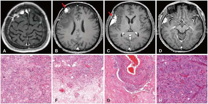 https://cdn.ncbi.nlm.nih.gov/pmc/blobs/cc34/11306841/77a7ac18e7f7/btrt-12-192-g003.jpg