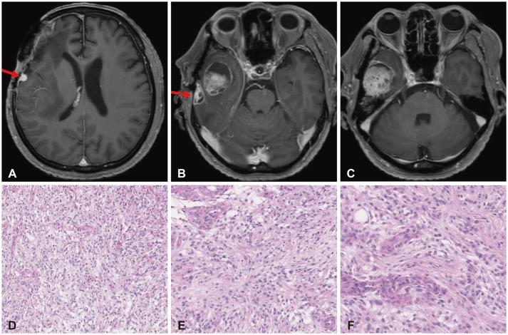 https://cdn.ncbi.nlm.nih.gov/pmc/blobs/cc34/11306841/d16c30abb733/btrt-12-192-g004.jpg