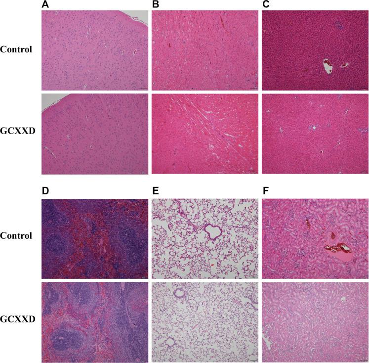 https://cdn.ncbi.nlm.nih.gov/pmc/blobs/cc3a/9871357/dc9ee6223b6a/fphar-13-1078665-g003.jpg