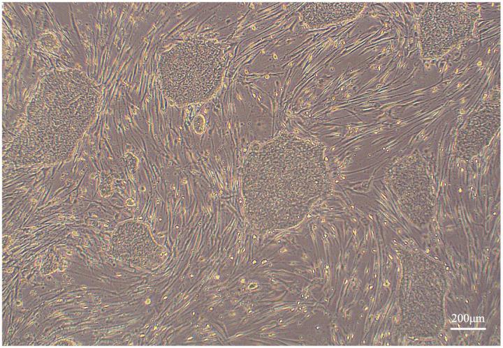 https://cdn.ncbi.nlm.nih.gov/pmc/blobs/cc40/12176200/b012922c8687/pone.0315161.g004.jpg