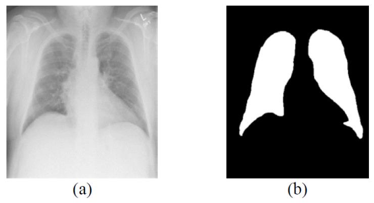 https://cdn.ncbi.nlm.nih.gov/pmc/blobs/cc41/9404743/bab3a9187752/bioengineering-09-00351-g003.jpg