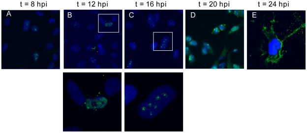 https://cdn.ncbi.nlm.nih.gov/pmc/blobs/cc43/2978725/a2573df5cd09/ppat.1001186.g001.jpg