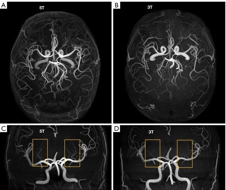 https://cdn.ncbi.nlm.nih.gov/pmc/blobs/cc47/10167427/4ca4ffe94018/qims-13-05-3222-f8.jpg