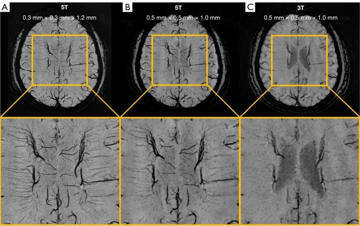 https://cdn.ncbi.nlm.nih.gov/pmc/blobs/cc47/10167427/a33a10f66886/qims-13-05-3222-f11.jpg