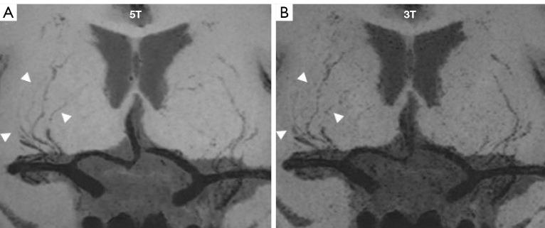https://cdn.ncbi.nlm.nih.gov/pmc/blobs/cc47/10167427/cee625ef4b6f/qims-13-05-3222-f9.jpg