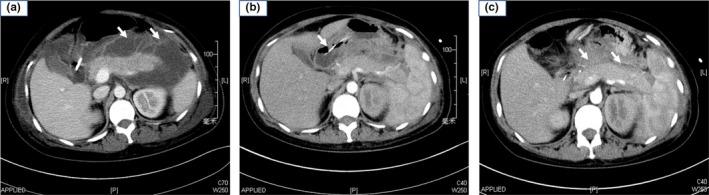 https://cdn.ncbi.nlm.nih.gov/pmc/blobs/cc4c/7057096/281270db4250/MGG3-8-e1048-g002.jpg