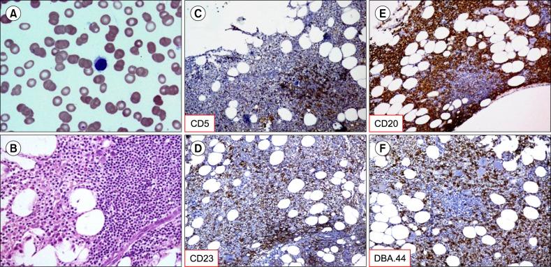 https://cdn.ncbi.nlm.nih.gov/pmc/blobs/cc4d/6021561/ec945cb0fa23/br-53-160-g001.jpg