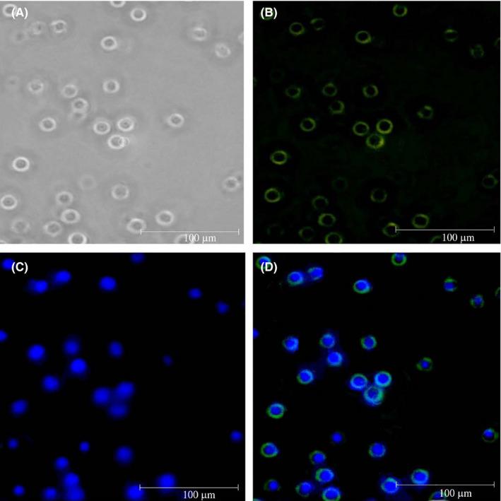 https://cdn.ncbi.nlm.nih.gov/pmc/blobs/cc4d/7893989/4541037802b2/CAS-112-589-g003.jpg