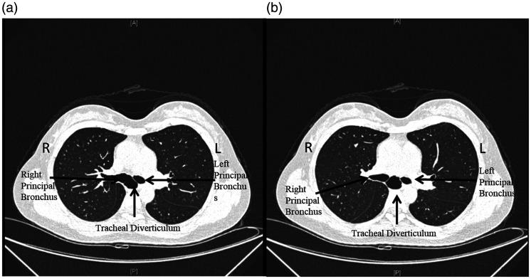 https://cdn.ncbi.nlm.nih.gov/pmc/blobs/cc4e/8647264/761993c1feac/10.1177_03000605211032855-fig1.jpg