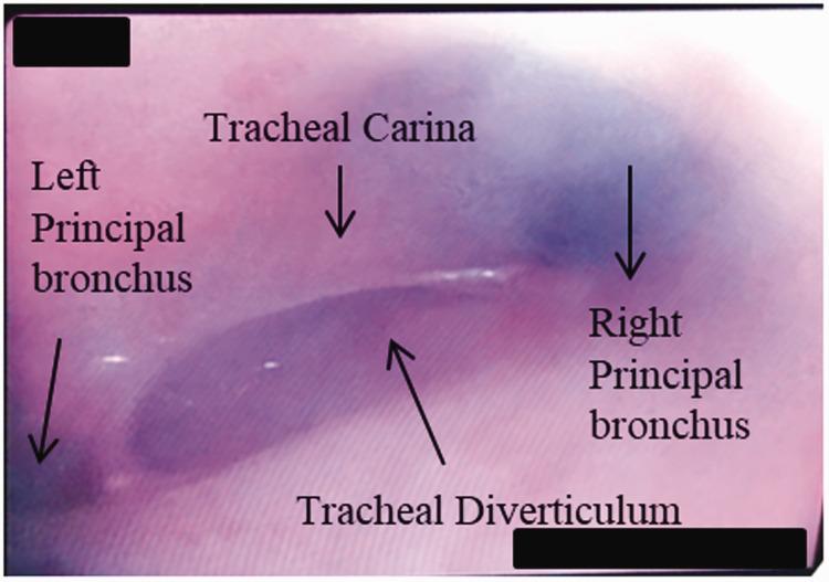 https://cdn.ncbi.nlm.nih.gov/pmc/blobs/cc4e/8647264/87db9ed6bfef/10.1177_03000605211032855-fig3.jpg