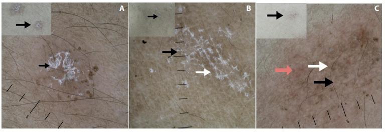 https://cdn.ncbi.nlm.nih.gov/pmc/blobs/cc4f/7875666/1e7e29677d41/dp1101a138g003.jpg