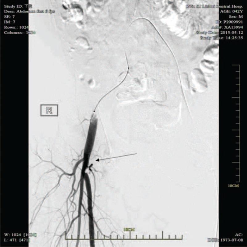 https://cdn.ncbi.nlm.nih.gov/pmc/blobs/cc55/4616739/3142f4c61d88/medi-94-e1738-g002.jpg