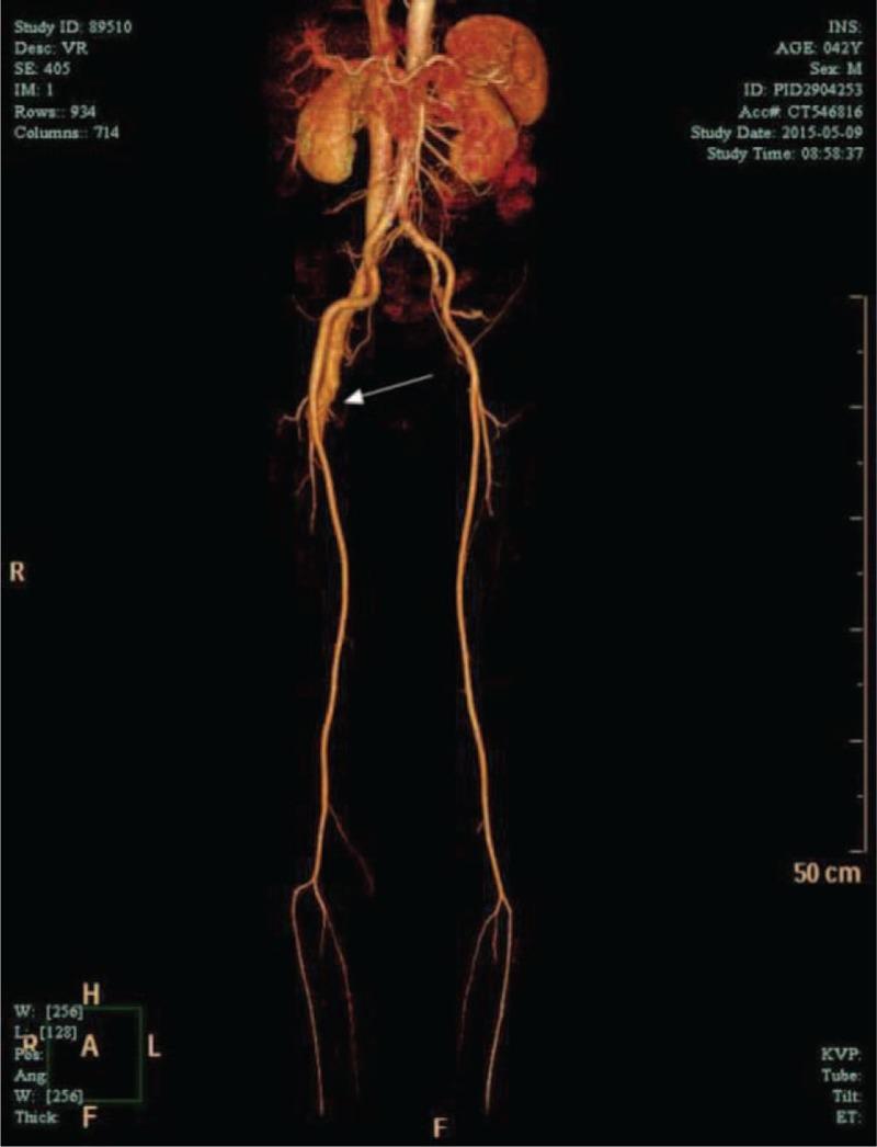 https://cdn.ncbi.nlm.nih.gov/pmc/blobs/cc55/4616739/9fb31f3a34c4/medi-94-e1738-g001.jpg